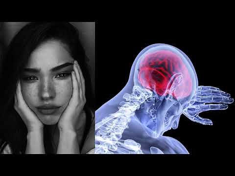 Catatonia introduction