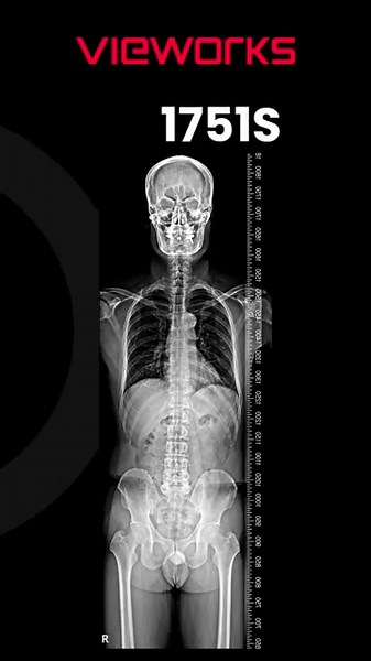 VIVIX-S 1751S Vieworks' Long Format X-ray Flat Panel Detector