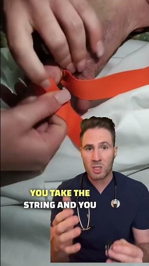 Ring Removal Trick #shorts