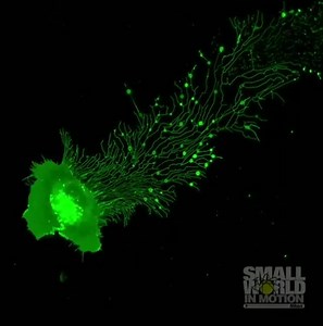 Migrating cells leave a trail behind them like a snail! 🐌🦠 The trail is formed by retraction fibers, sprinkled with instruction packages called migrasomes that inform other cells to "follow that trail". The process is called migracytosis. It's so pretty! Image credit: #Nikon small world #cell #migration #macrophage #migrasome #migracytosis #trail #science #Omics4all | Genetics, Genomics & Bioinformatics Research Updates