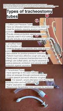 Types of tracheostomy tubes