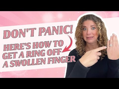 Don't Panic! Here's how to get a ring off a swollen finger