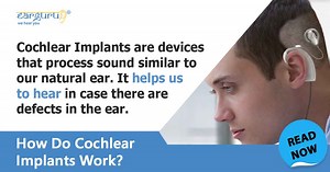 How do cochlear implants work? Explained in simple terms