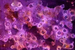 Pink Mold: What It Is, How to Remove It & Keep It Away