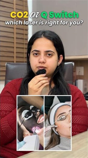 CO2 Laser Facial | Q Switch Laser for Face | Laser For glowing skin | Skin Glow Laser | Laser Toning