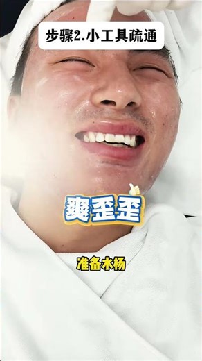 First Acne Treatment at 26 😱 Years of Breakouts—See His Transformation