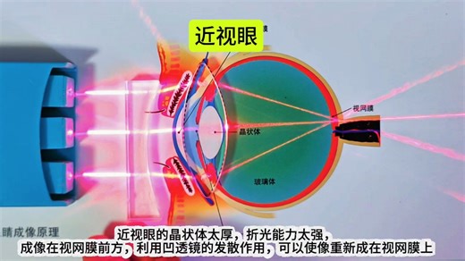 看完此视频瞬间明白眼睛的物理光学原理！