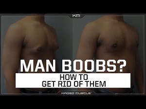 How to Get Rid of Man Boobs (Gynecomastia) for a Better Physique