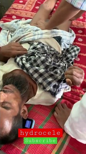 hydrocele #surgery #short