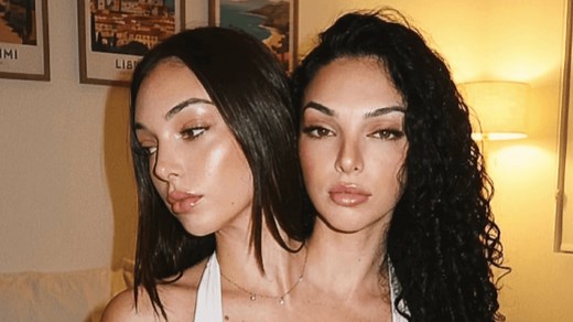 Truth behind viral conjoined twins with over 280,000 followers