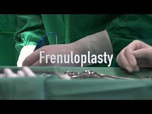 frenuloplasty