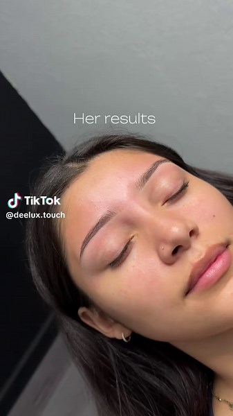 Brow Mapping Techniques: Stunning Before and After Results