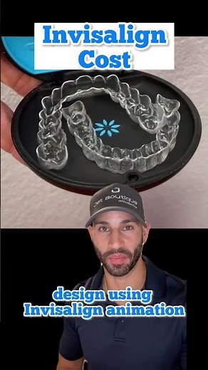 Invisalign cost. The answer to “How much is Invisalign?”