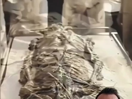 外星人身体研究