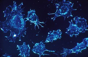 Pathogenic Cancer: A New Theory