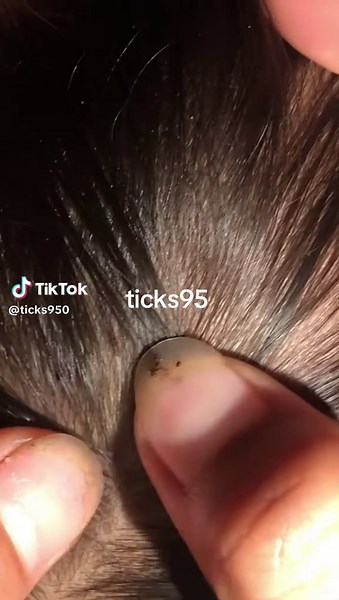 ticks95 on TikTok