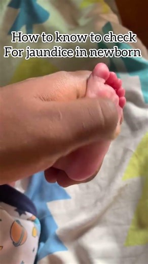Do this to know if you newborn has jaundice.