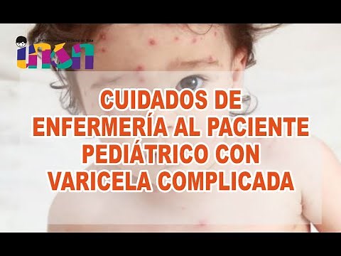 Cuidados de Enfermería al paciente pediátrico con Varicela Complicada - Telecapacitación INSN