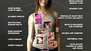 “Inhalants” refers to the vapours from toxic substances which are inhaled (breathe in) to reach a quick high. Of more than 1,000 household and other common products that could be abused as inhalants. The chemicals are rapidly absorbed through the lungs into the bloodstream and quickly reach the brain and other organs, sometimes causing irreversible physical and mental damage. For more info visit: https://www.drugfreeworld.ie/drugfacts/inhalants.html | The Truth About Drugs Ireland