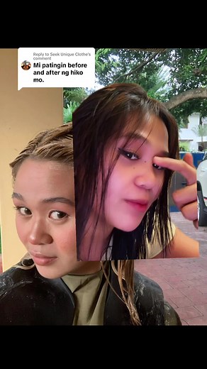 Hiko Nose Lift Transformation: Before and After Results