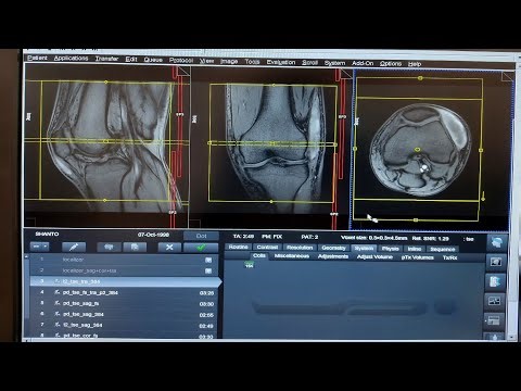 How to MRI of Knee Joint | Planning & Positioning Tutorial (SIEMENS 1.5T / 3T)