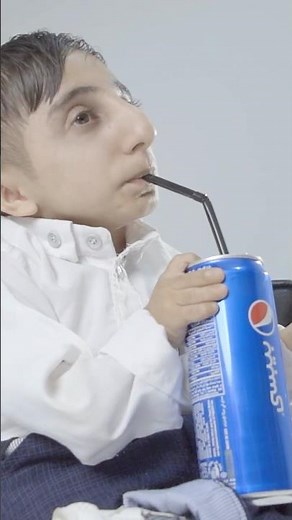 World's Smallest Hands - Afshin Ghaderzadeh #shorts
