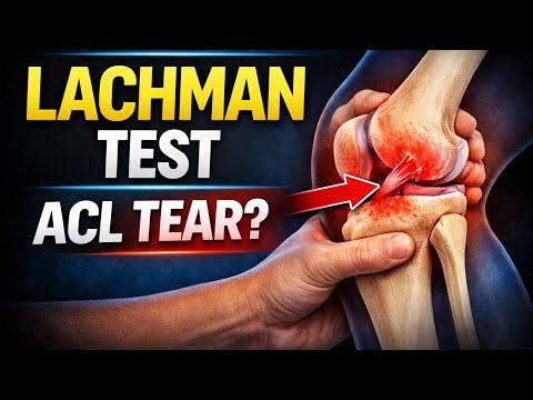 Lachman Test Made Easy 🔥 | Knee Trauma Exam #education #quickrevision #mbbs #doctor 