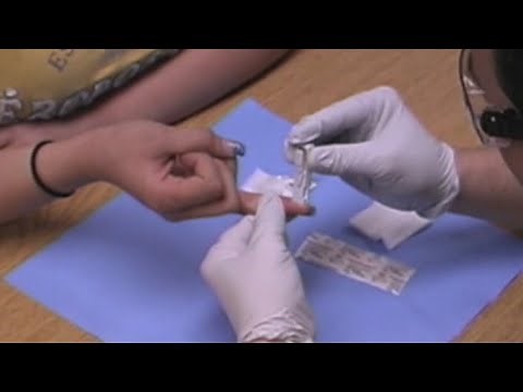 Part 5. Detailing A Live Capillary Stick, Clean-up And Hand Washing.