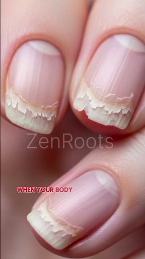 Why Your Nails Keep Breaking (And How To Strengthen Them Naturally)