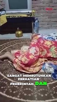 Kondisi Memprihatinkan Maria Andini (17) Derita Gagal Jantung dan Hidup dalam Keluarga Disabilitas