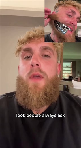 Jake Paul Discusses Jaw Injury After Fight With Joshua