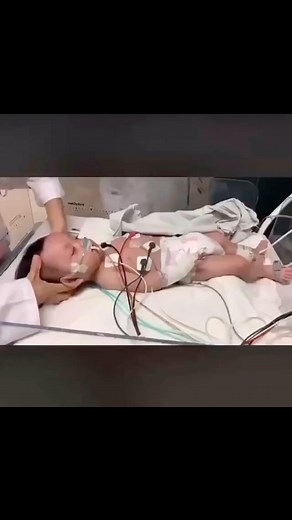 Medical Doctors | Meningitis Examination Tests (a) Kernig’s sign- Extension of the knee on a flexed hip at 90° causes restriction and pain Beyond 135° , (b)... | Instagram