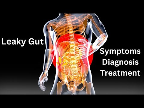 The Ultimate Guide to Leaky Gut: Causes, Symptoms, and Treatment