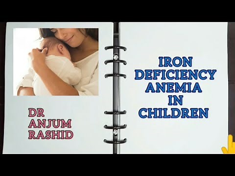 Iron Deficiency Anemia IDA Causes, Signs & Symptoms, Diagnosis and Treatment | Pediatrics