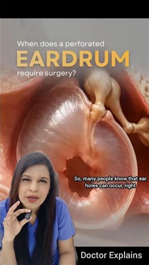 Can you use ear drops #drnalliramya #ent #vizag #ent #eaddrops #earhole #ear #earpain #eardischarge