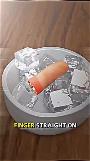🚨 Don’t Put a Cut Finger on Ice! This Trick Could Save It