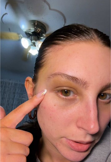 Understanding Black Eyes and Eye Color Changes