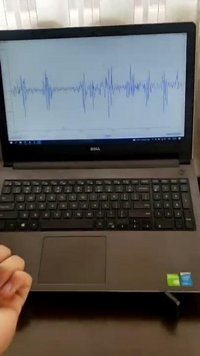 Electromiografía EMG con un Arduino UNO y una Shield de Olimex
