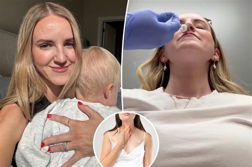 I have ‘no burp syndrome’ — now I’m getting burp surgery so I can drink soda without pain