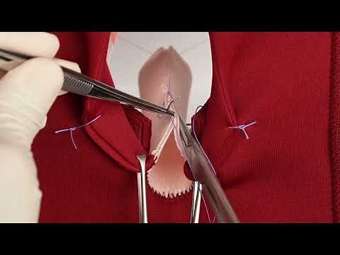 Anal sphincter repair training