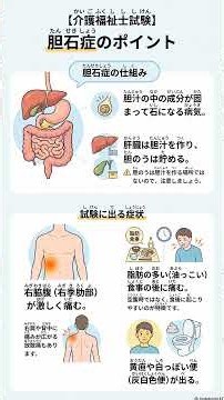 Gallstones: A Short Guide