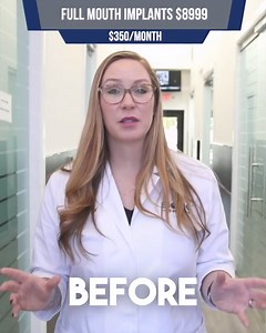 123K views · 11K reactions | Dental Costs Got You Down? All-on-4 Implants for Only $8,999 at Bionic Smile. Quality, Guaranteed. | Bionic Smile | Facebook