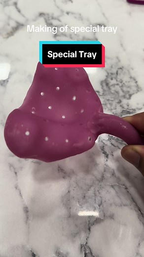 Crafting a Special Tray for Dental Laboratory | Dentek Dental Lab