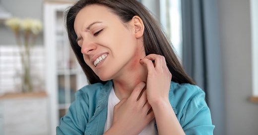 Itching and Kidney Disease