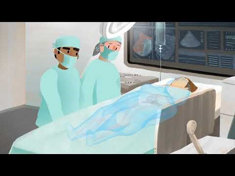 What is catheter ablation?