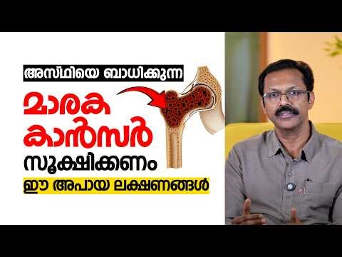 അസ്ഥിയെ ബാധിക്കുന്ന കാൻസർ ഈ അപായ ലക്ഷണങ്ങൾ ശ്രദ്ധിക്കുക | symptoms of bone cancer