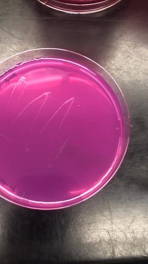 isolating a fungus colony #science #scienceplate #loop #microbiology
