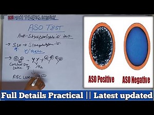 Aso test | Aso test in hindi | Aso test microbiology | Antistreptolysin o titer