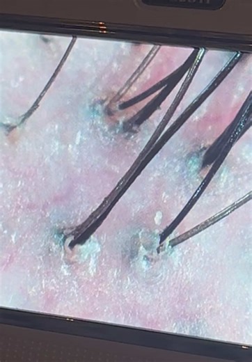 Sebum Detox and Scalp Care Essentials