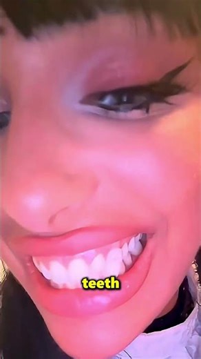 This Girl Couldn’t Take Off Her Vampire Teeth 😱